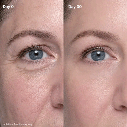 Viyoa™ Eye Renewal Crème